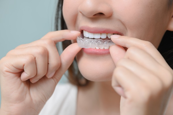 FAQs: Clear Aligners For Adults